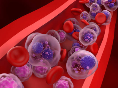 Support Salman's Fight Against Multiple Myeloma